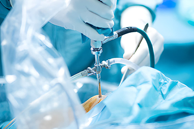 Arthroscopic Surgery