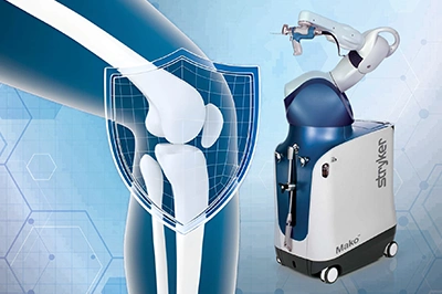 Robotic Knee Replacement